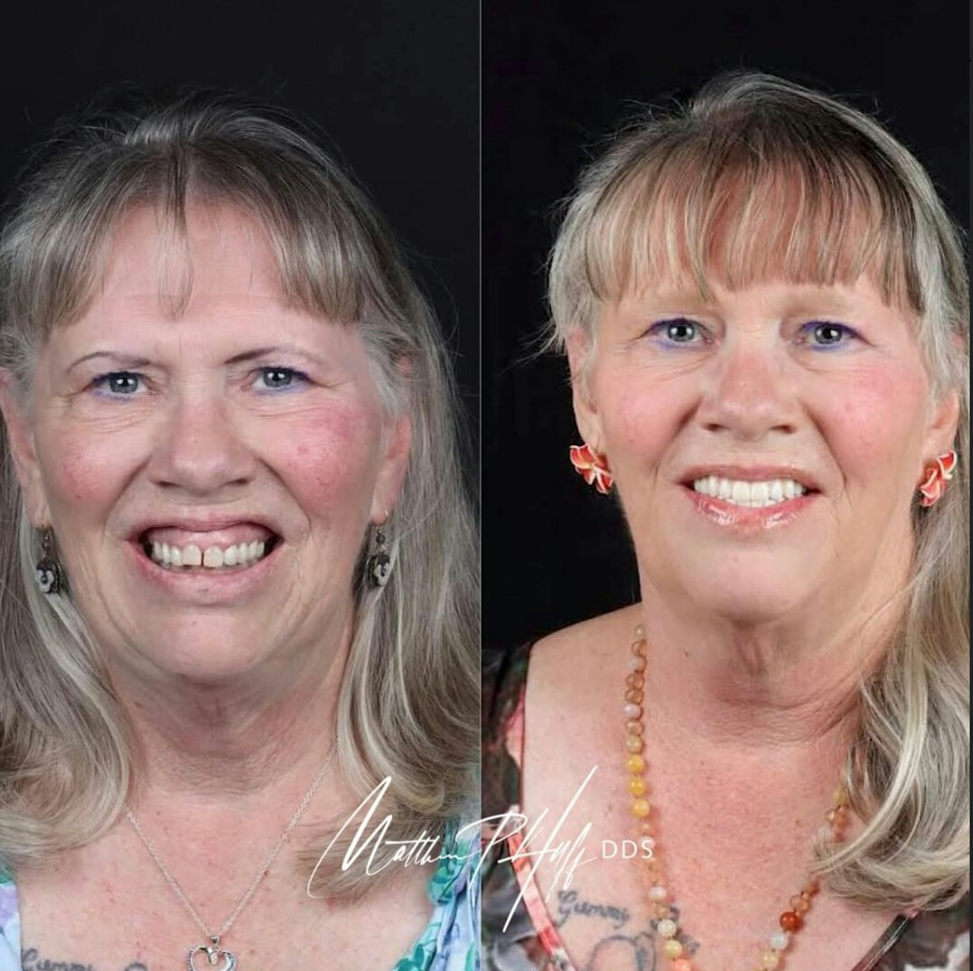 before and after transformation